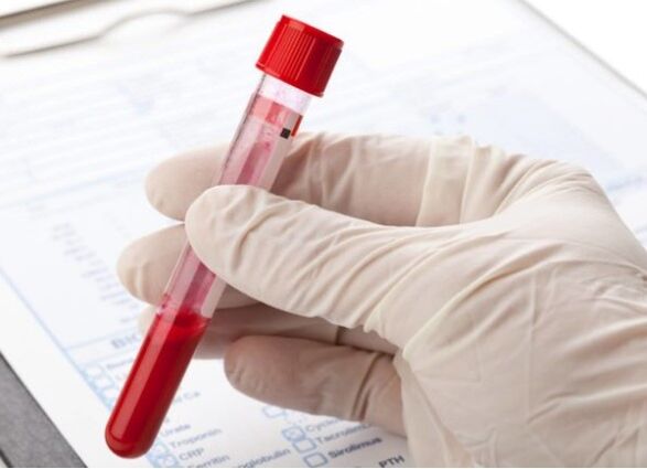 Laboratorijske diagnostične metode vam omogočajo prepoznavanje patološke mikroflore ali virusa
