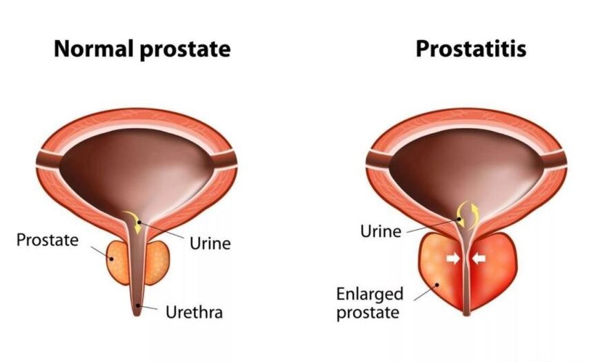 Normalno prostato in vneto